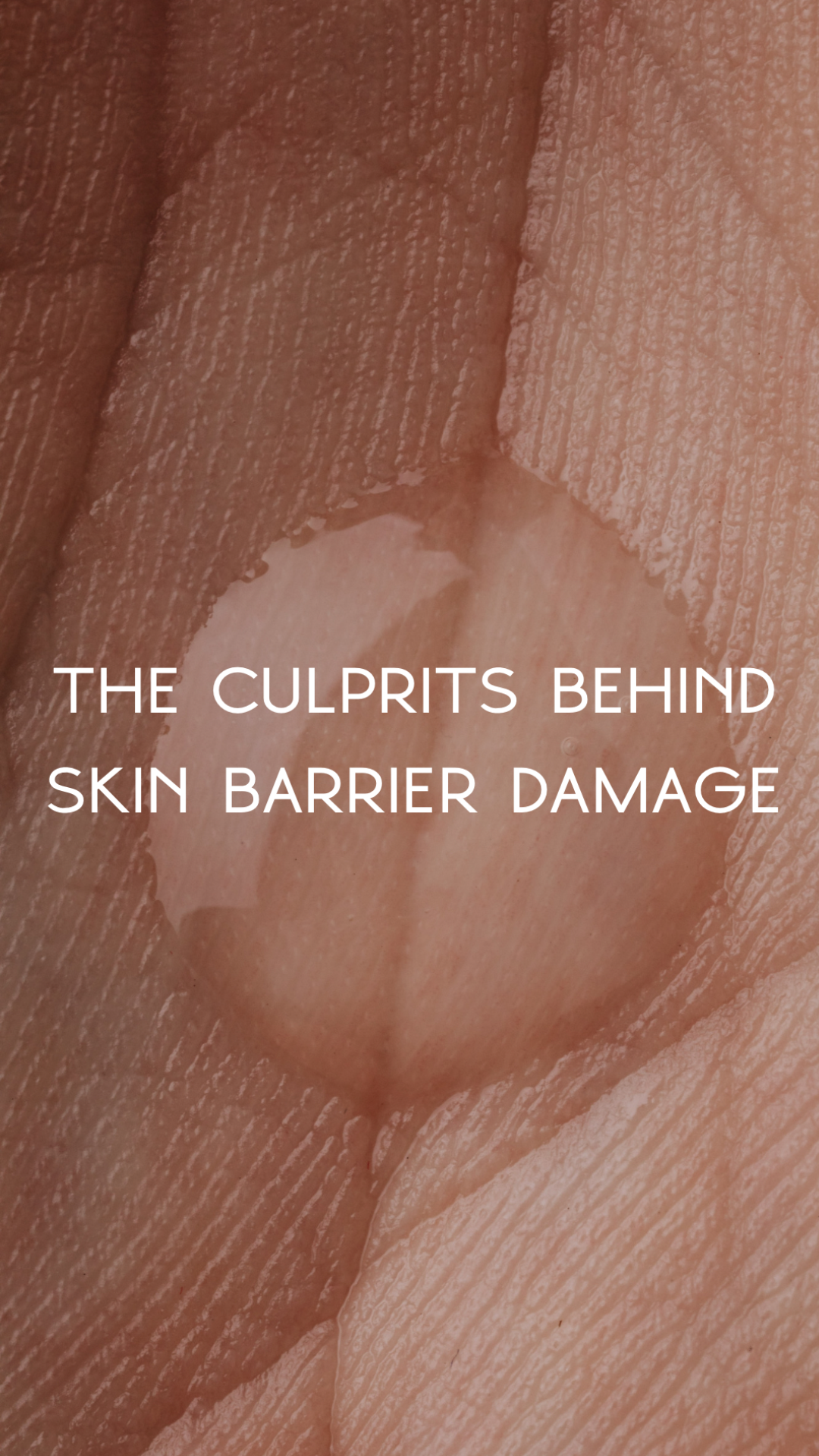 What causes skin barrier damage?